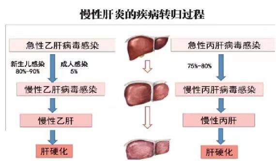 【健康科普】世界肝炎日——堅(jiān)持早預(yù)防,加強(qiáng)檢測(cè)發(fā)現(xiàn),規(guī)范抗病毒治療